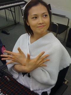 Yui 歌手 のすっぴんビフォア アフター画像 あげてけ